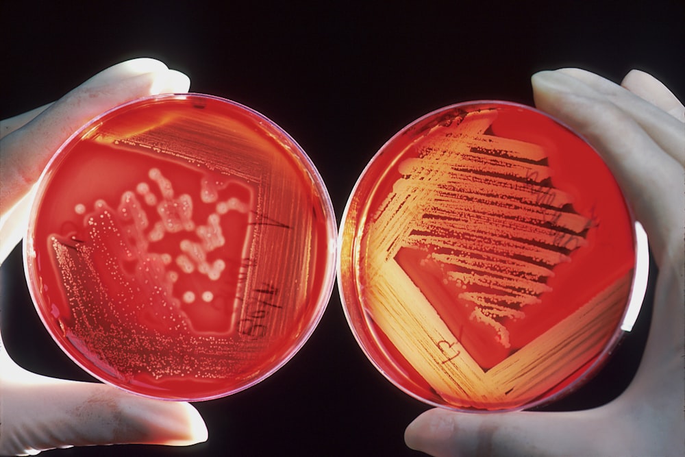 um par de mãos segurando uma placa de Petri vermelha