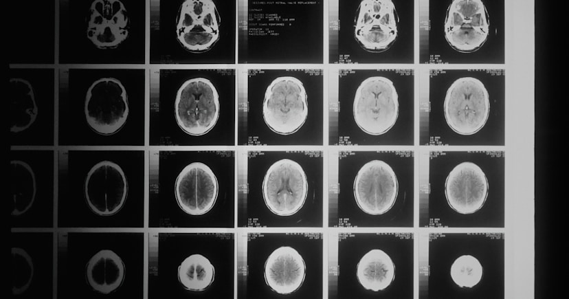 a black and white photo of various mri images