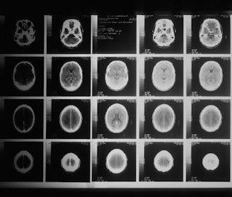 a black and white photo of various mri images