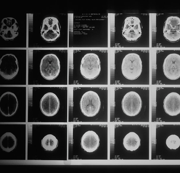 a black and white photo of various mri images