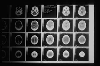 a black and white photo of various mri images