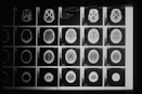 a black and white photo of various mri images