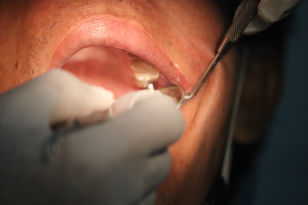 a close up of a person with a tooth brush