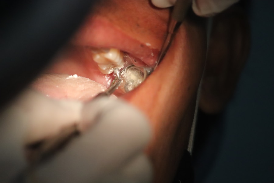 Peri-implant tissue photography protocol