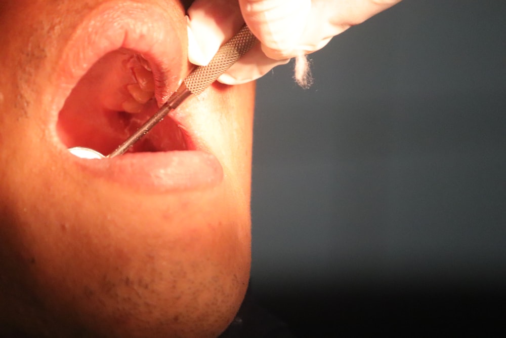 a close up of a person getting their teeth brushed