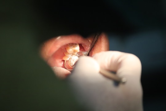 Close-up of a dentist gently examining a patient's teeth with modern tools.