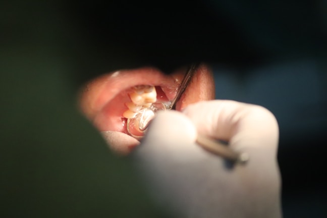 A close-up image of a dental examination taking place. A dentist wearing gloves is using dental tools inside a patient's mouth to inspect or treat the teeth.