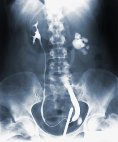an x - ray of a man's back and neck