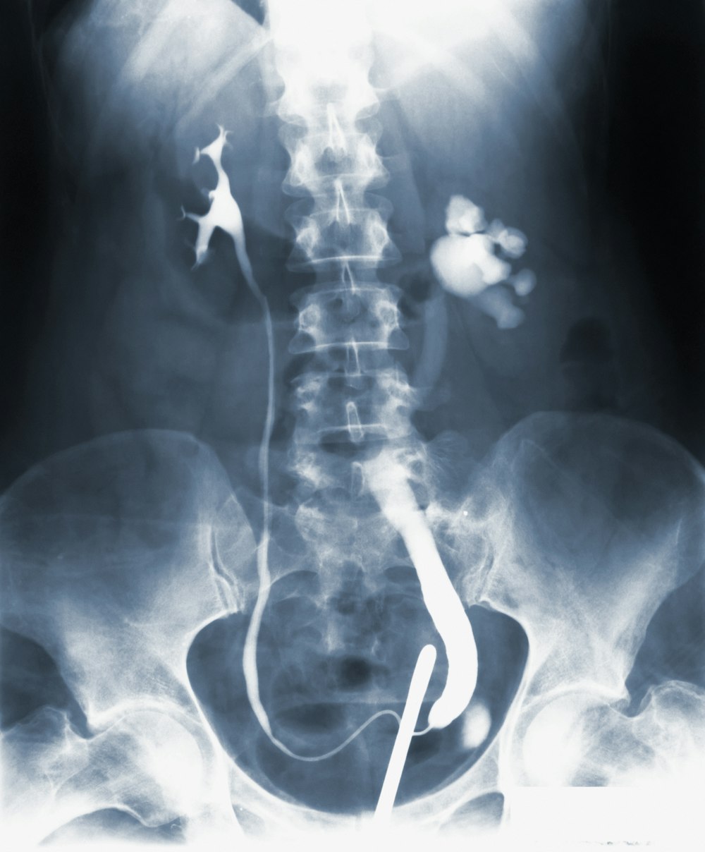 Ein Röntgenbild des Rückens und des Nackens eines Mannes