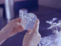 Hands holding a transparent petri dish divided into sections, each containing a small colony of microorganisms. The background is blurred, hinting at a laboratory setting with some equipment visible.