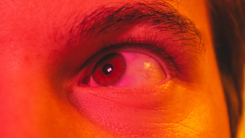 a close up of a person's red eye