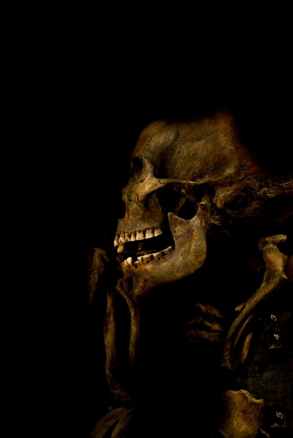 um esqueleto humano com um olhar assustador em seu rosto