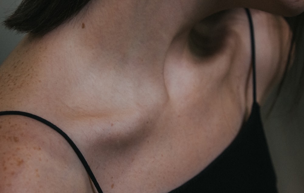 a close up of a woman with freckles on her neck