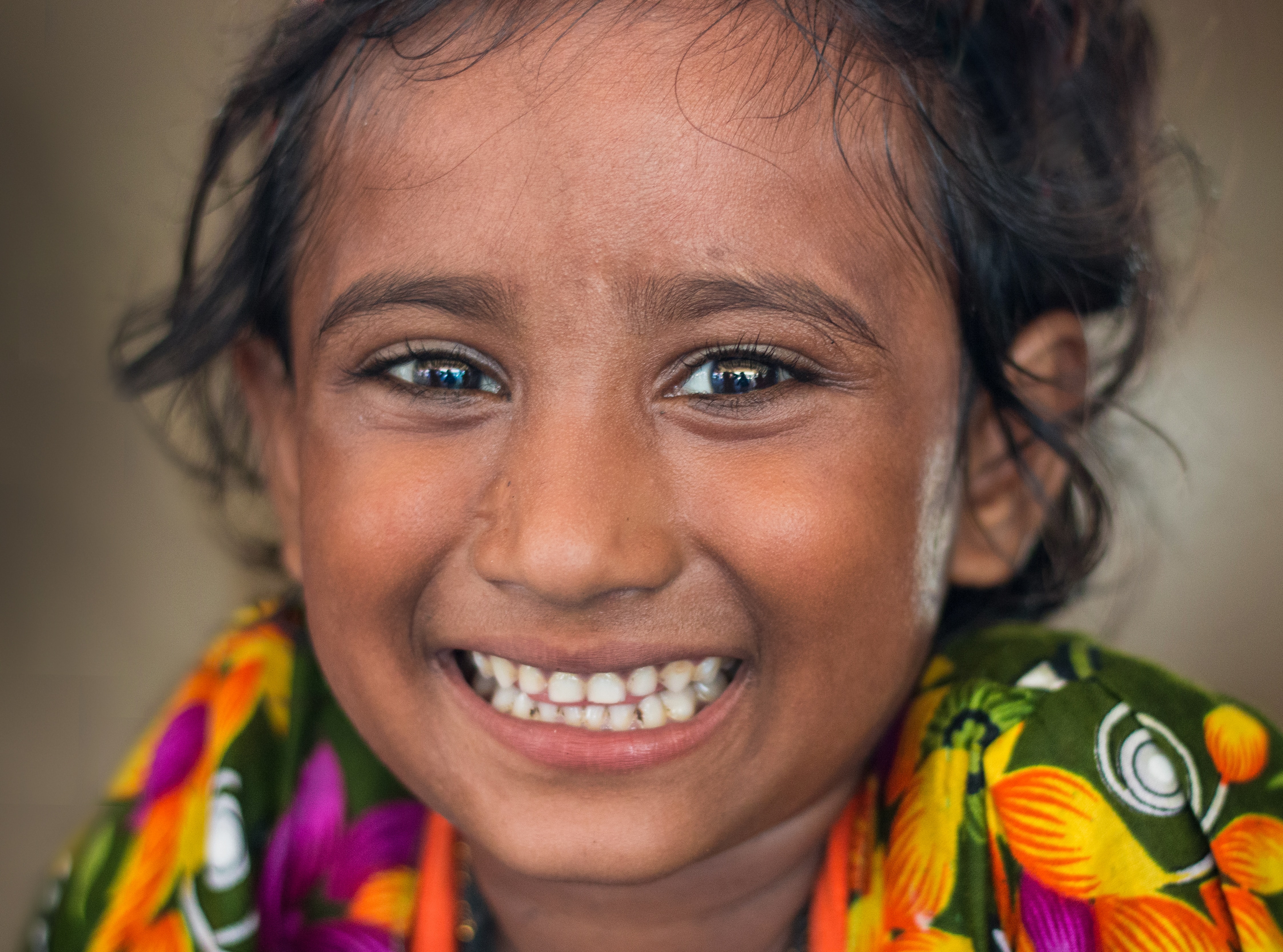 Dental transformation - young girl
