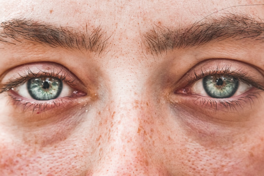 a close up of a person with freckles on their eyes