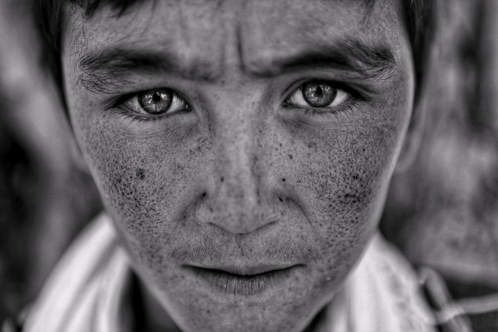 a black and white photo of a man with freckled hair