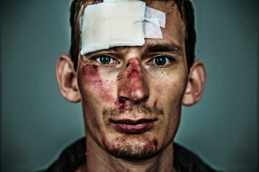 A person with facial injuries is depicted, featuring bruises, cuts, and a bandage on the forehead. The background is a muted grey color, and the focus is on the expressive eyes and the aftermath of an apparent incident.