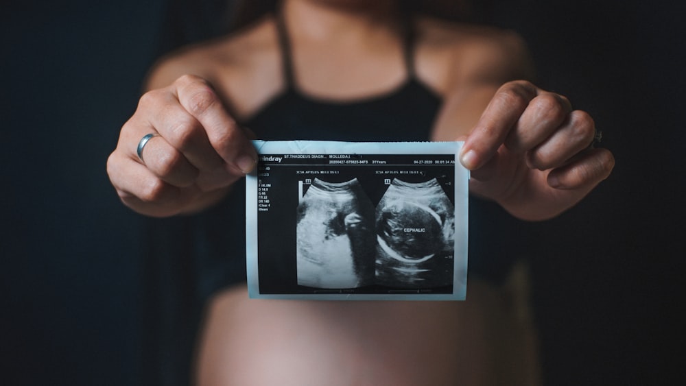 a woman holding up an x - ray of her stomach