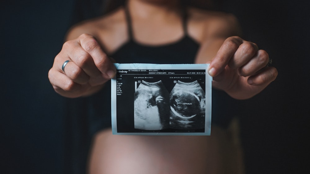Une femme tenant une radiographie de son ventre