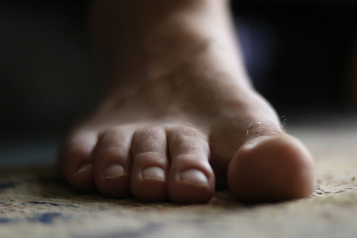 Close-up of a bare adult foot, representing nail fungus (onychomycosis) assessment