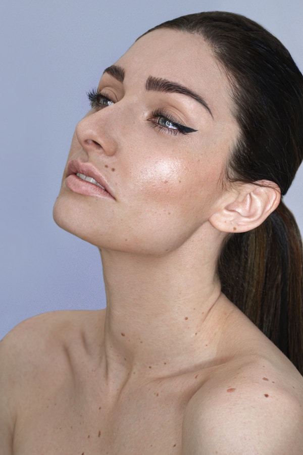 P.N. — before and after under-eye filler