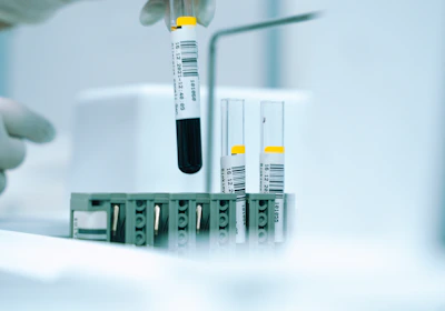 a gloved hand holding a test tube filled with liquid