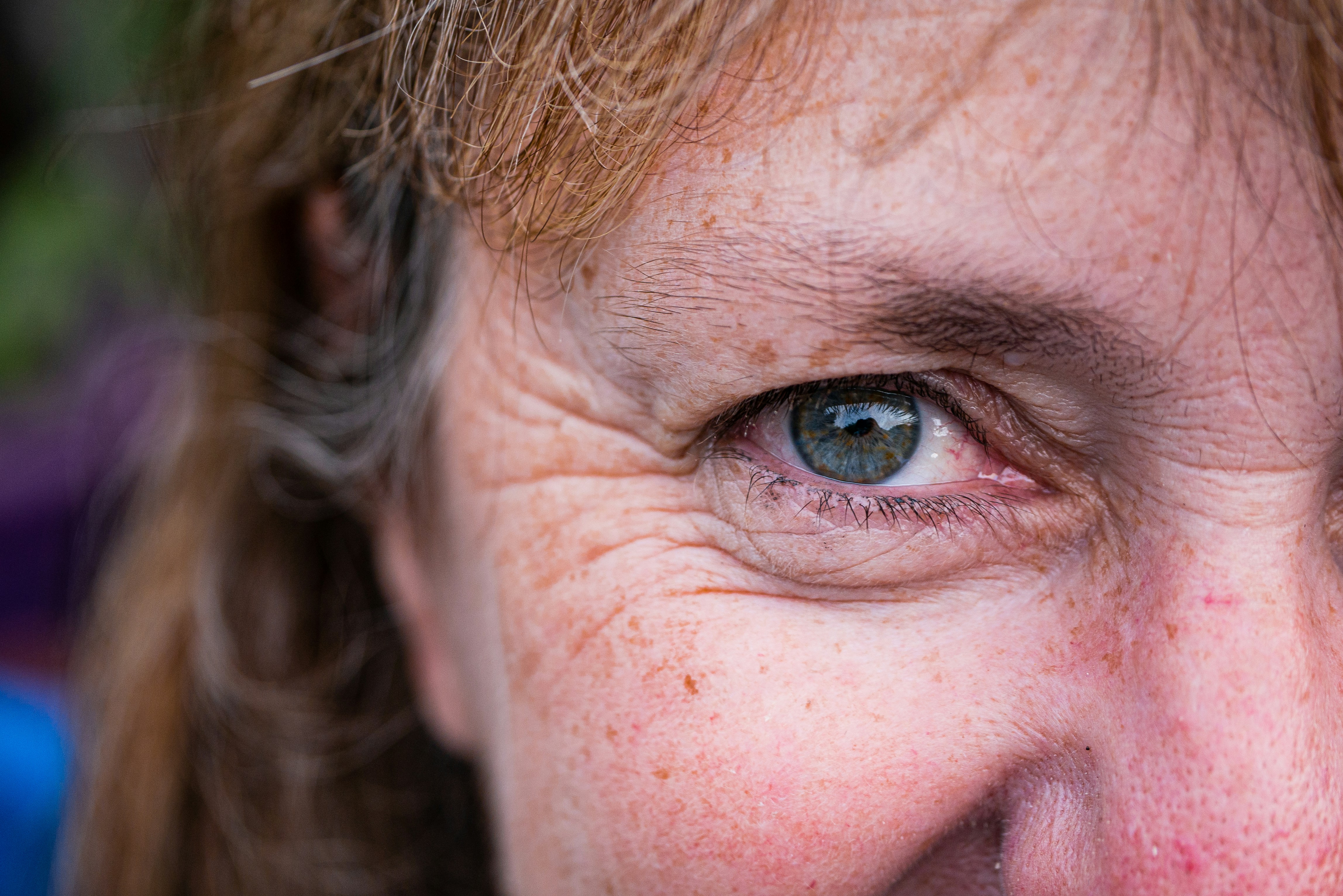 a close up of a person with freckled hair