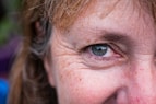 a close up of a person with freckled hair