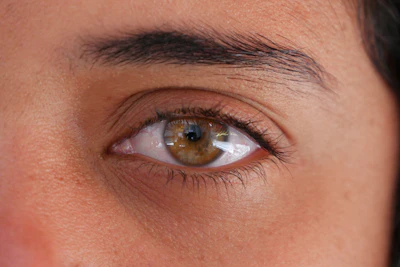 Can You Sleep With Contacts In?