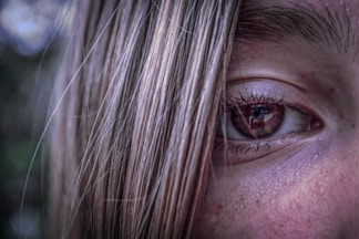 a close up of a person's face with a bloody eye