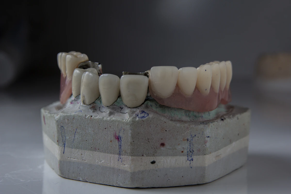 İllüstratif görsel: a close up of a tooth model on a table