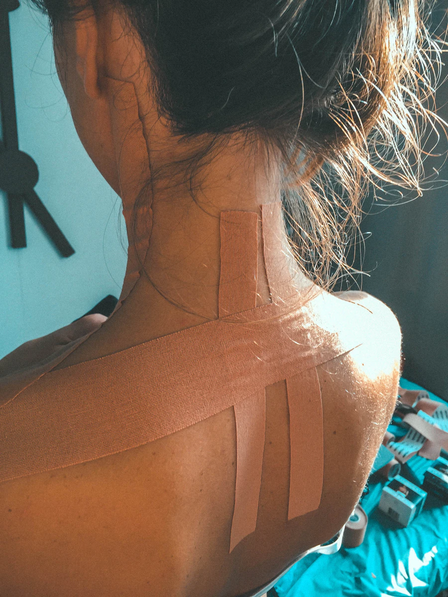 Kinesio Tape Kezelés