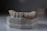 A dental mold featuring a set of artificial teeth is placed on a smooth surface. The mold is crafted from a greyish material with slight discolorations and scribbles. The artificial teeth are aligned neatly, resembling a realistic dental setup with gums depicted in a darker, reddish shade.