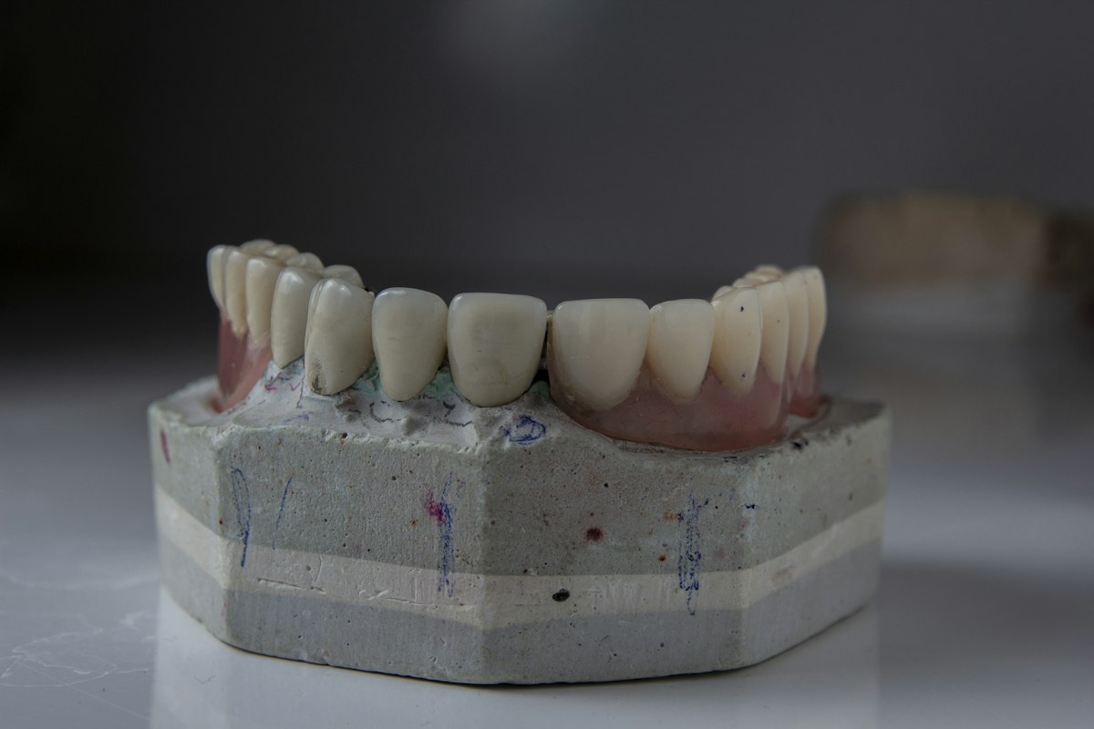 Close-up of a dental crown restoration on a model