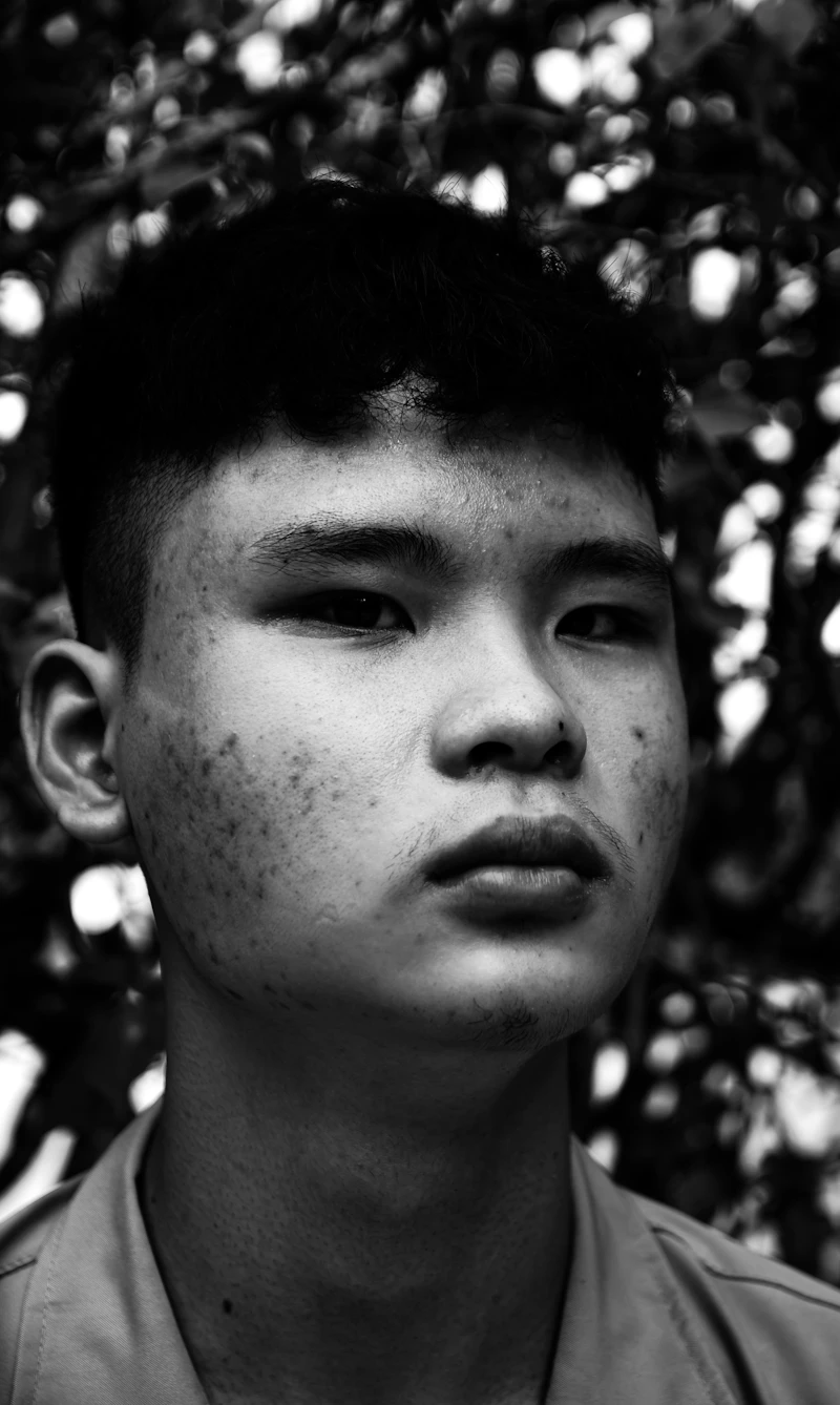 ภาพขาวดำใบหน้าชายหนุ่มที่มีรอยสิว