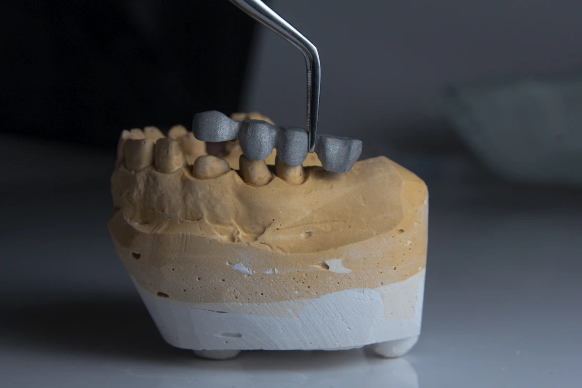 İllüstratif görsel: a model of a tooth with a toothbrush in it