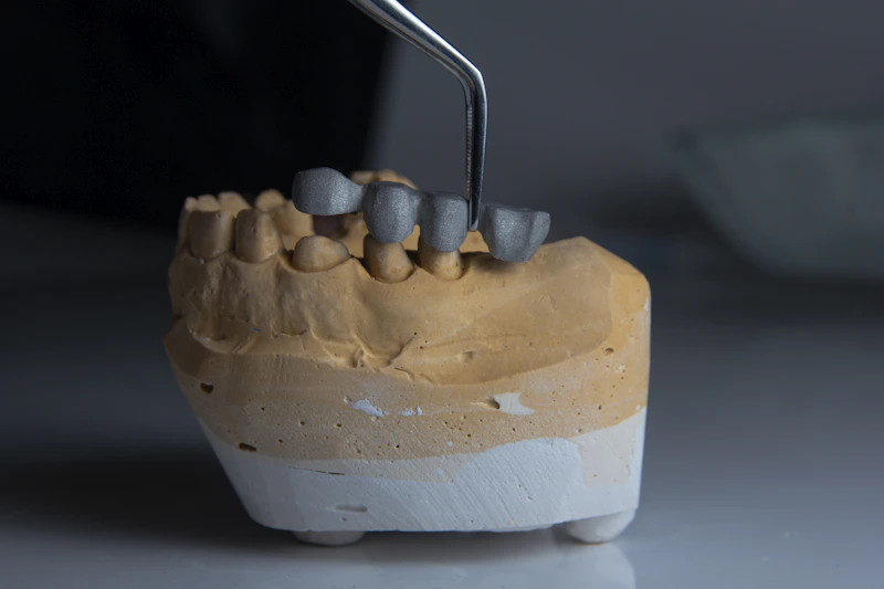 Tooth model used to demonstrate a dental filling