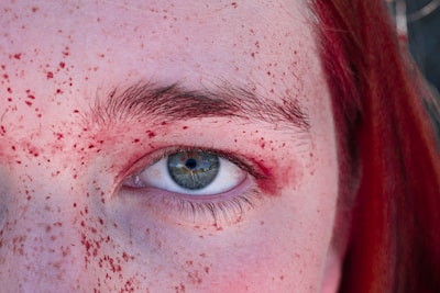 A close-up view of an eye with blue iris surrounded by red freckles. The person has red hair, and the skin tone is pale. The red freckles create a striking contrast with the skin and eye.
