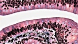 A microscopic view showcasing cells arranged in layers, featuring various shapes and sizes. Predominantly pinkish-purple hues with darker circular structures scattered throughout suggest staining techniques often used in biological imaging. The image has clear, defined boundaries with a white background separating the sections.