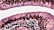 A microscopic view showcasing cells arranged in layers, featuring various shapes and sizes. Predominantly pinkish-purple hues with darker circular structures scattered throughout suggest staining techniques often used in biological imaging. The image has clear, defined boundaries with a white background separating the sections.