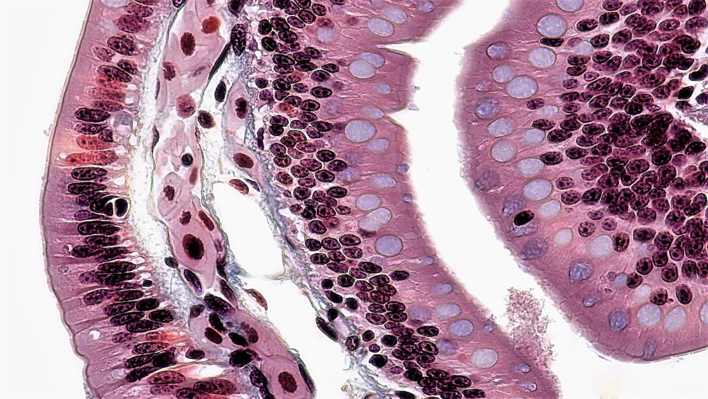 a close up of a section of a human stomach
