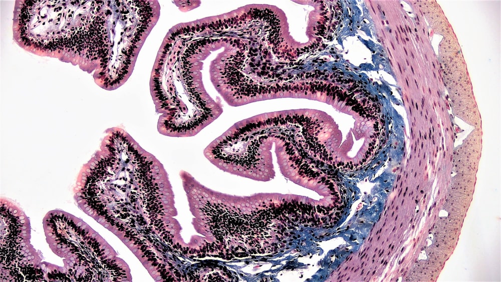 a close up of a section of a human stomach