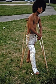 a shirtless man with crutches and a broken leg