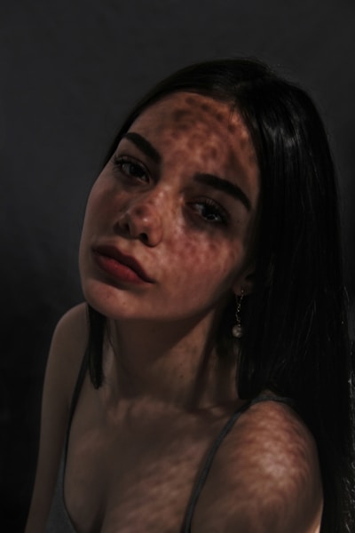 a woman with freckles on her face looking at the camera