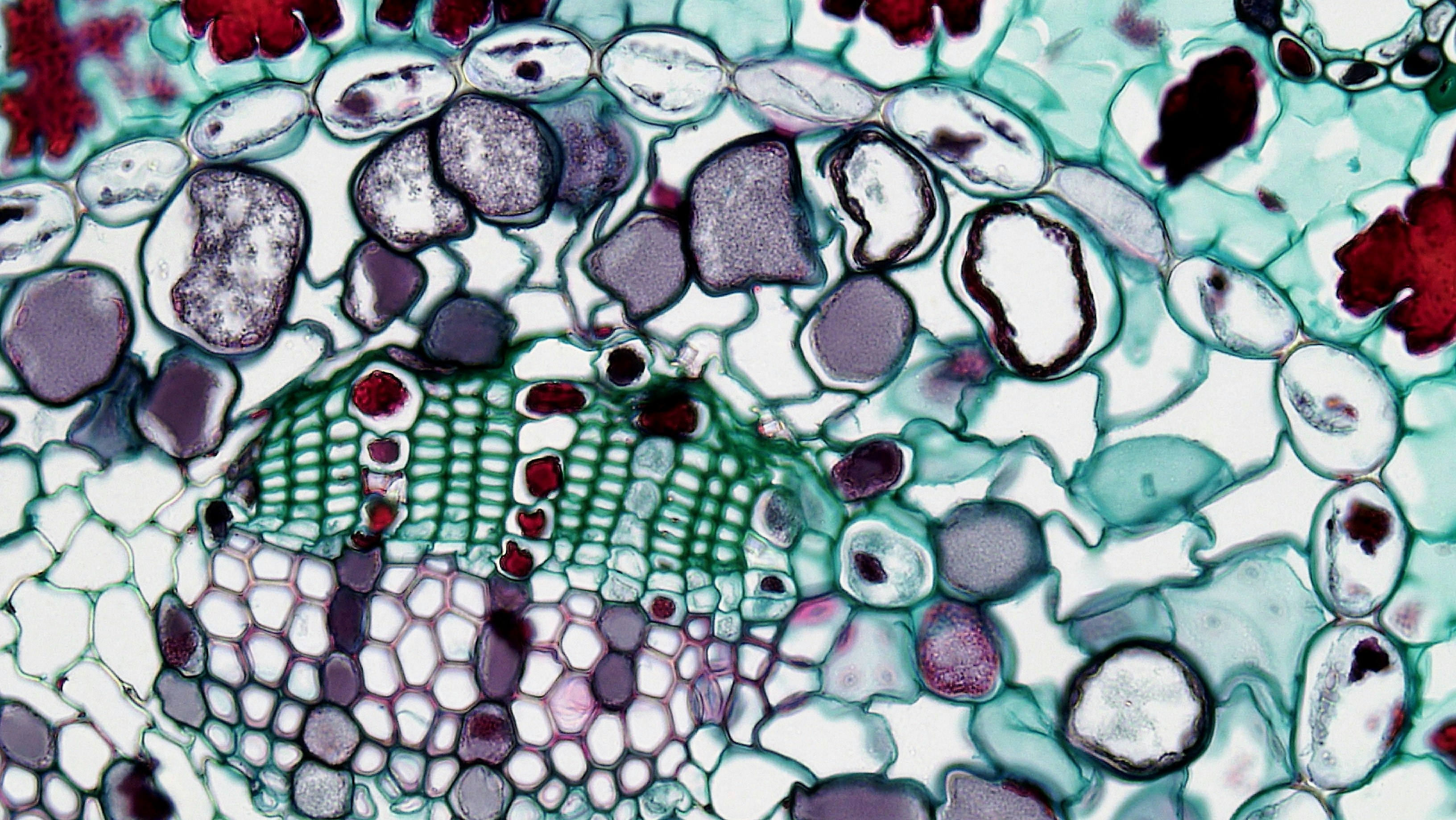 BCC Bioscience Image Library is a media file repository of images and video clips made available to educators and students in the biological sciences. The resources are created by faculty, staff and students of Berkshire Community College and are licensed under Creative Commons 0. This means all content is free, with no restrictions on how the material may be used, reused, adapted or modified for any purposes, without restriction under copyright or database law.