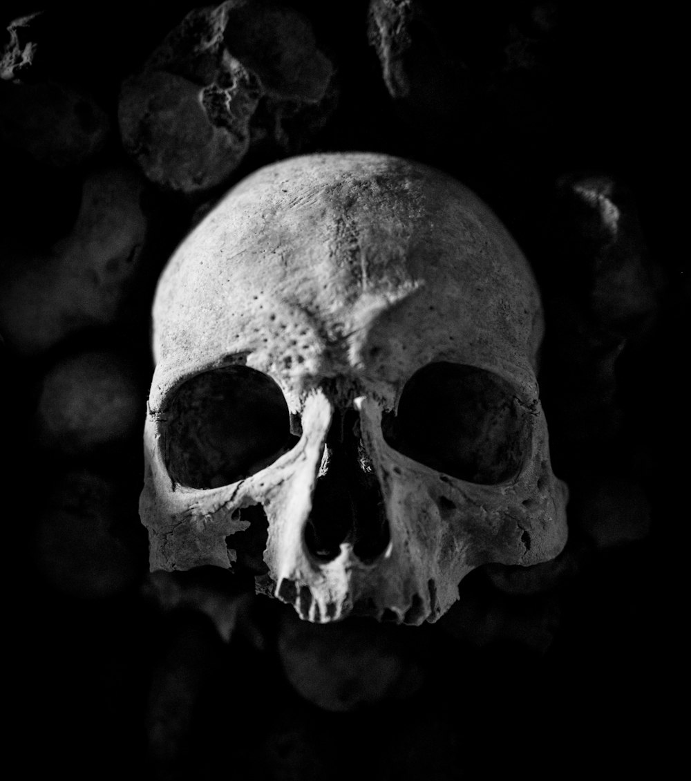 a black and white photo of a human skull