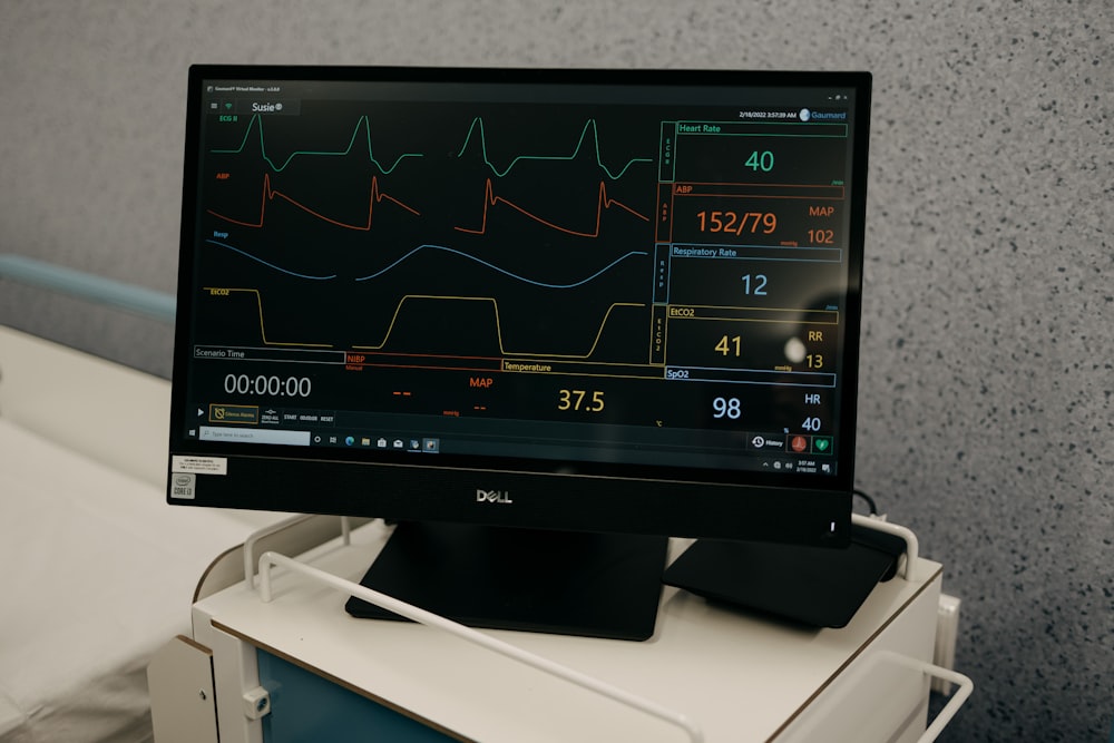 A monitor displaying a patient's vitals. 