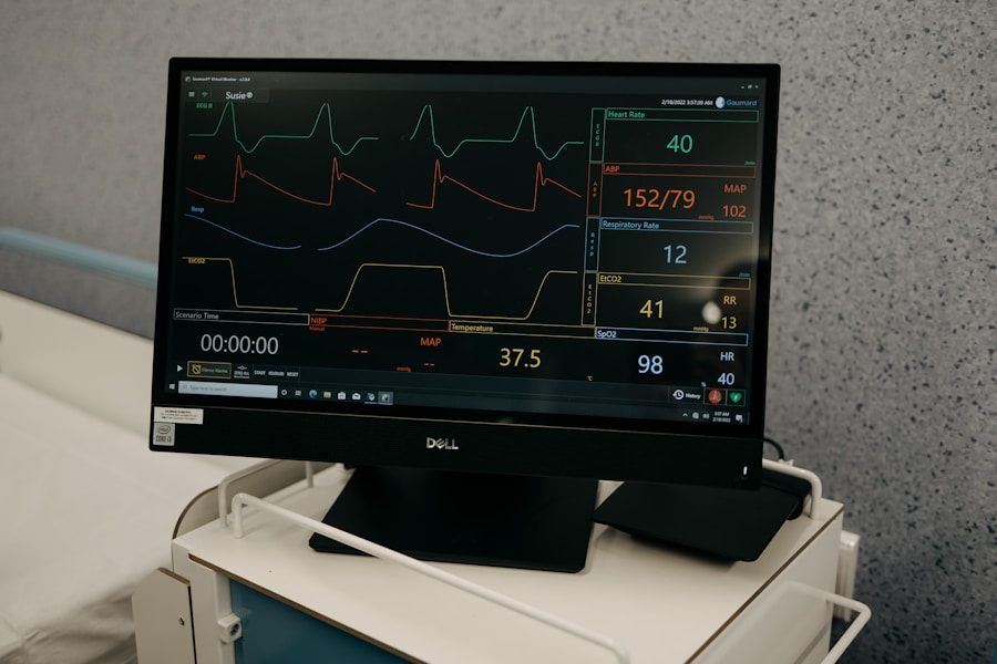 Holter EKG monitoring: Kada i kako se koristi za preciznu dijagnostiku rada srca?