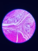 a close up of a section of a human's stomach
