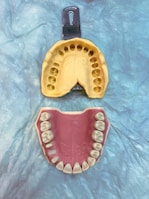 cr technology dental stone type IV